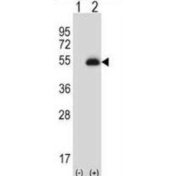 Paired Box Protein Pax-6 (PAX6) Antibody