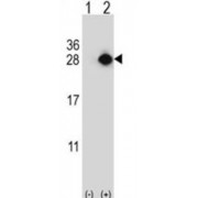 YEATS Domain Containing 4 (YEATS4) Antibody