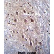 Homeodomain-Interacting Protein Kinase 4 (HIPK4) Antibody