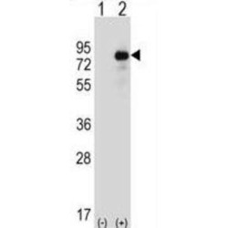 Homeodomain-Interacting Protein Kinase 4 (HIPK4) Antibody