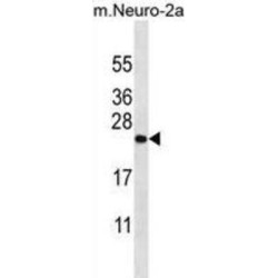 Zinc Finger CCHC-Type And RNA-Binding Motif-Containing Protein 1 (ZCRB1) Antibody