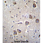 Neuritin-Like Protein (NRN1L) Antibody