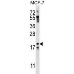 Neuritin-Like Protein (NRN1L) Antibody