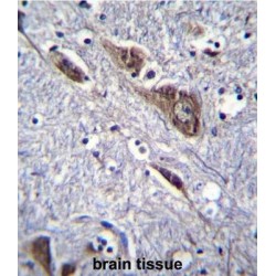 ELAV (Embryonic Lethal, Abnormal Vision, Drosophila)-Like 2 (Hu Antigen B) (ELAVL2) Antibody