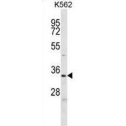 ELAV (Embryonic Lethal, Abnormal Vision, Drosophila)-Like 2 (Hu Antigen B) (ELAVL2) Antibody