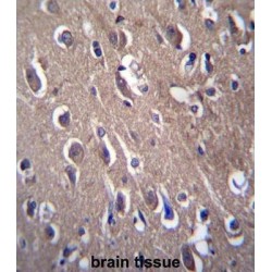 Serum Paraoxonase/arylesterase 2 (PON2) Antibody