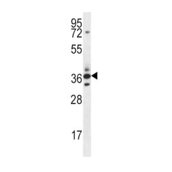 Secreted Frizzled Related Protein 5 (SFRP5) Antibody