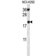 Ribosomal Protein S12 (RPS12) Antibody