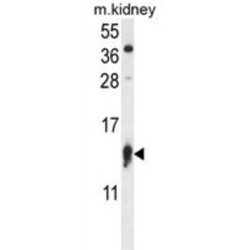 Ribosomal Protein S12 (RPS12) Antibody