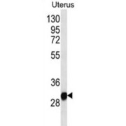 Ring Finger Protein 148 (RNF148) Antibody