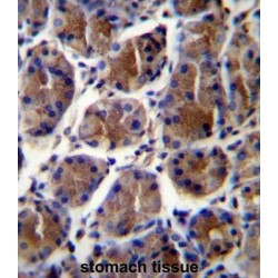 Gastric Intrinsic Factor (GIF) Antibody