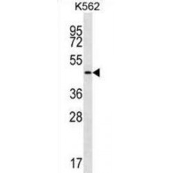 Gastric Intrinsic Factor (GIF) Antibody