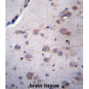 NADH Ubiquinone Oxidoreductase Complex Assembly Factor 4 (NDUFAF4) Antibody