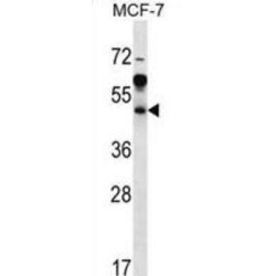 Arfaptin 1 (ARFIP1) Antibody