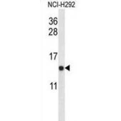 Ubiquinol-Cytochrome C Reductase Binding Protein (UQCRB) Antibody