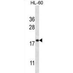 Transmembrane Protein 70, Mitochondrial (TMM70) Antibody