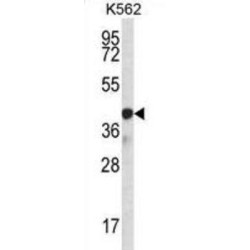 Krueppel-Like Factor 14 (SP6) Antibody