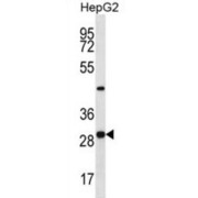 Pyridoxal Phosphate Binding Protein (PROSC) Antibody