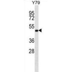 Zinc Finger FYVE Domain-Containing Protein 19 (ZFYVE19) Antibody