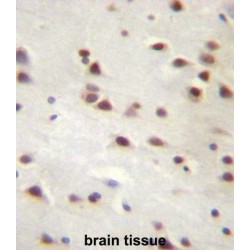 Ankyrin Repeat Domain 6 (ANKRD6) Antibody