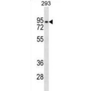 Western blot analysis of Human brain lysate (20 µg per lane) using Ankyrin Repeat Domain 6 Antibody (1/1000 dilution) followed by HRP-conjugated Goat Anti-Rabbit IgG H+L secondary antibody (1/10000 dilution). Blocking/dilution was carried out with 5% NFDM/TBST. <br>Calculated MW: 80 kDa.