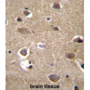 Mitochondrial Ribosomal Protein L9 (MRPL9) Antibody