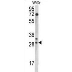 Mitochondrial Ribosomal Protein L9 (MRPL9) Antibody