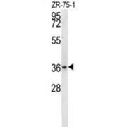 Deaminated Glutathione Amidase (NIT1) Antibody