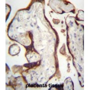 Chorionic Somatomammotropin Hormone-Like 1 (CSHL1) Antibody