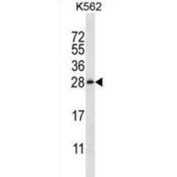 Chorionic Somatomammotropin Hormone-Like 1 (CSHL1) Antibody