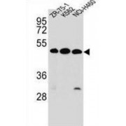 Kremen Protein 2 (KREMEN2) Antibody