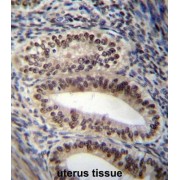 Progesterone Receptor (PGR) Antibody