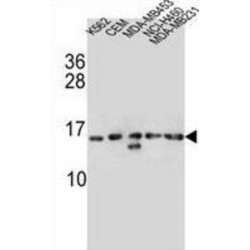 Histone Cluster 1, H2ab (HIST1H2AB) Antibody