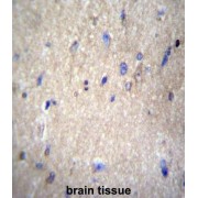 NEDD8 Activating Enzyme E1 Subunit 1 (NAE1) Antibody