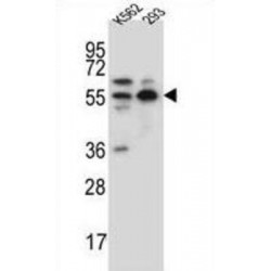 NEDD8 Activating Enzyme E1 Subunit 1 (NAE1) Antibody