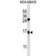 Granulysin (M. tb GNLY) Antibody