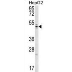 WD Repeat-Containing Protein 12 (WDR12) Antibody