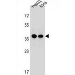 ER Lipid Raft Associated Protein 1 (ERLIN1) Antibody