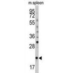 BH3-Interacting Domain Death Agonist (BID) Antibody