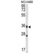 Muscleblind Like Splicing Regulator 3 (MBNL3) Antibody