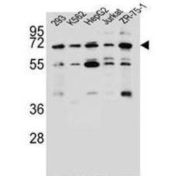 Potassium Voltage-Gated Channel Subfamily V Member 2 (KCNV2) Antibody