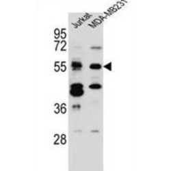 Trinucleotide Repeat Containing 4 (TNRC4) Antibody