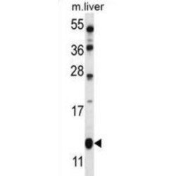 Vesicle Transport Protein GOT1B (GOT1B) Antibody