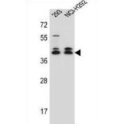 Doublesex- And Mab-3-Related Transcription Factor C2 (DMRTC2) Antibody