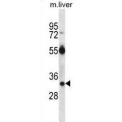 RAS, Dexamethasone-Induced 1 (RASD1) Antibody