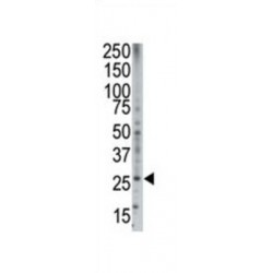 Bok BH3 Domain Antibody