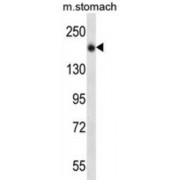 Protein Unc-13 Homolog B (UNC13B) Antibody