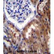 PR15B Antibody