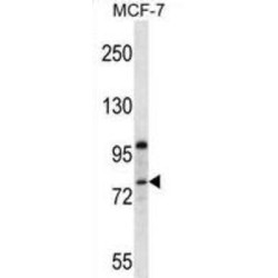 PR15B Antibody