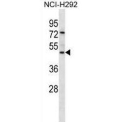 Pancreatic Secretory Granule Membrane Major Glycoprotein GP2 (GP2) Antibody